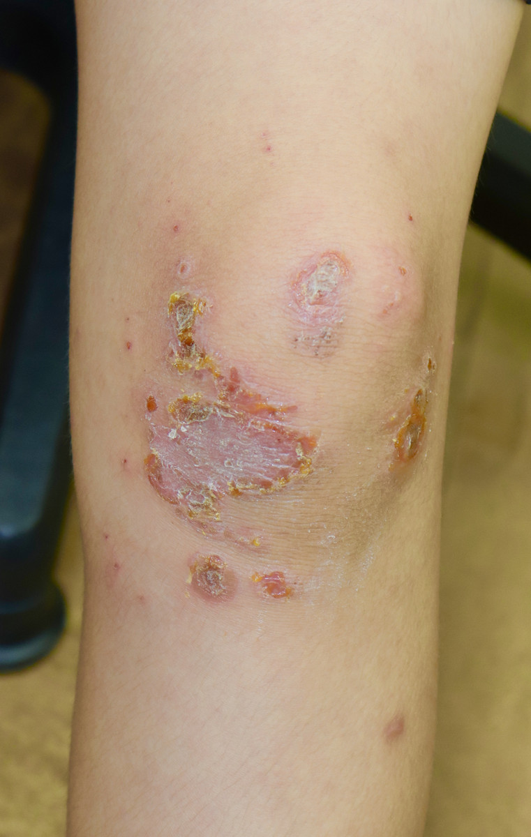 Fullsizeoutput_20e6_2